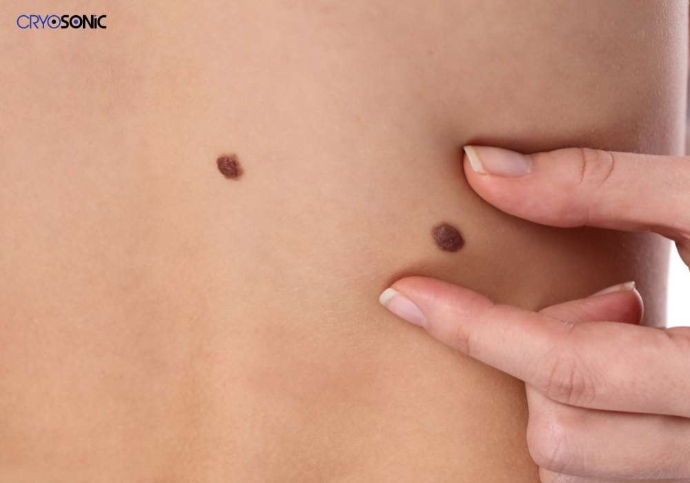 Infection Risk and Poor Aftercare Staines