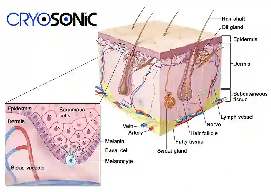 How Cryotherapy Stimulates Melanocyte Activity Staines
